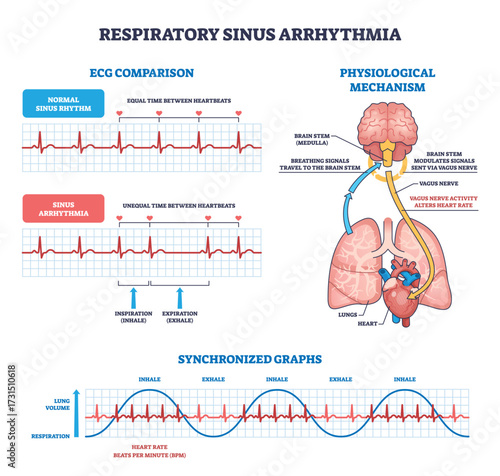 Respiratory sinus arrhythmia is shown with heart, lungs, and ECG graphs to illustrate heart rate changes during breathing. Outline diagram