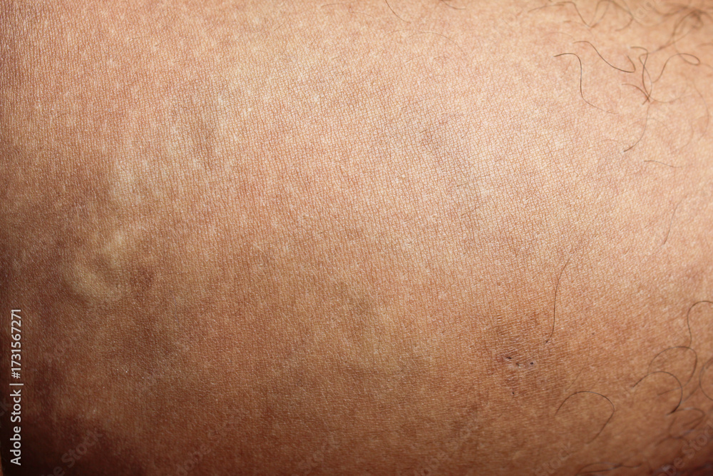 Naklejka premium Asian man skin texture close up. Man with tan skin