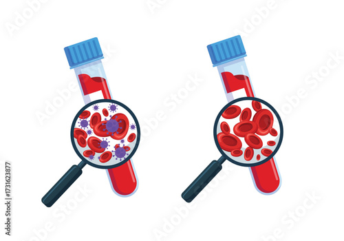 Set of laboratory blood test for infection.  magnifying glass and test tube with blood sample to research and find viruses and bacteria in hematology analysis cartoon vector illustration
