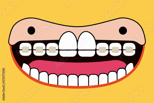 Joyful cartoon mouth illustration with dental braces, depicting orthodontic health and happiness on a vibrant yellow background.