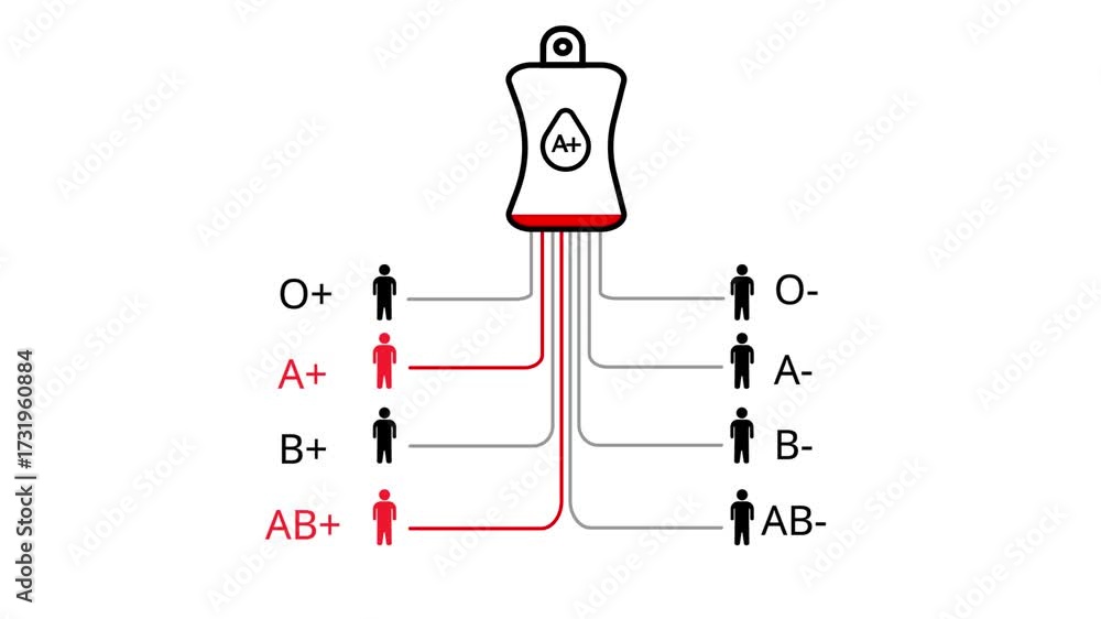 Blood type compatibility chart with A positive blood bag and compatible ...