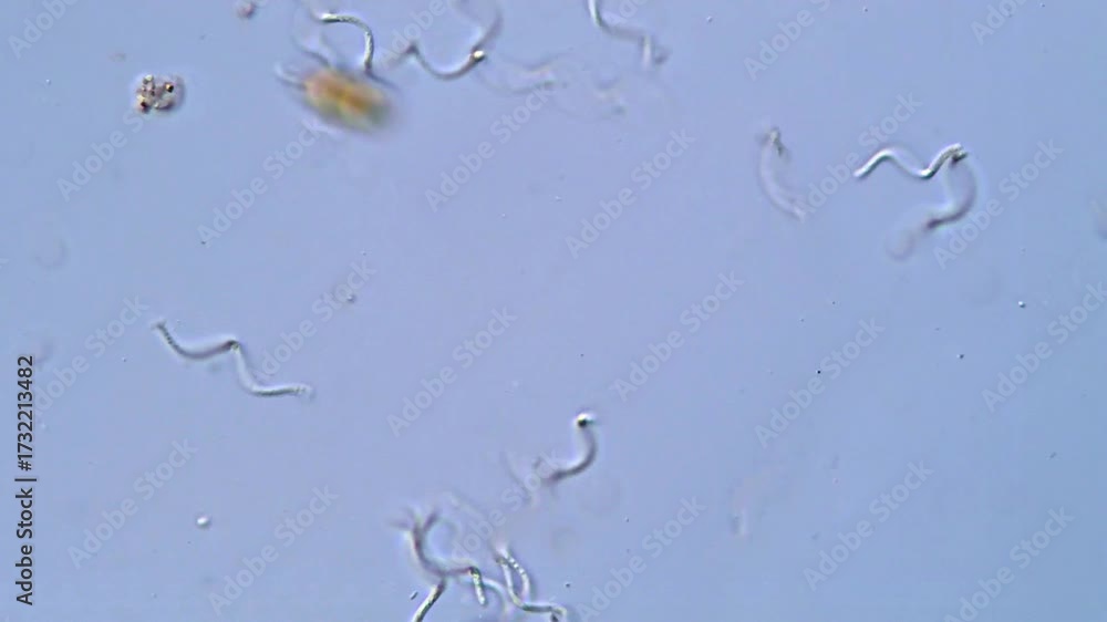 Spirocheten Spirochetes bacteria under microscope 400x magnification Stock 비디오 ...