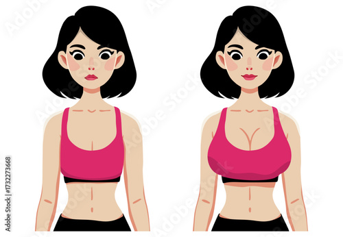 Woman before and after breast augmentation