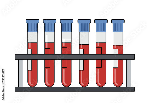 Analyzing blood samples in a laboratory laboratory setting scientific research controlled environment view