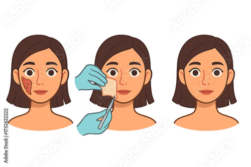Artificial skin creation process, transplantology treatment, girl’s face skin restoration, damaged skin healing, cosmetic surgery, medical procedure, vector cartoon illustration