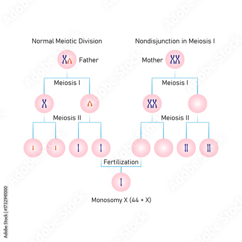 Meiotic Nondisjunction in Monosomy X Science Design. Vector Illustration.
