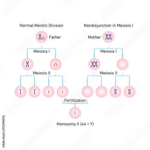 Meiotic Nondisjunction in Monosomy Y Science Design. Vector Illustration.