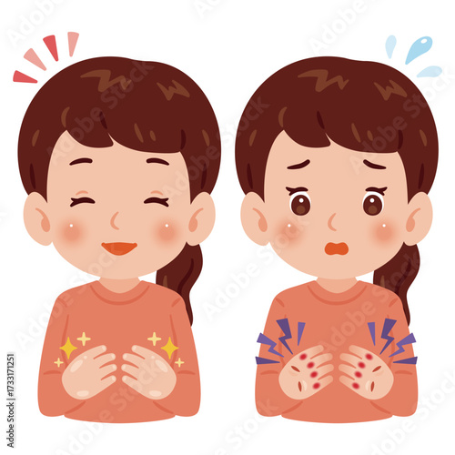 健康な手の女性と荒れた手の女性　上半身イラスト／Woman with healthy hands and woman with rough hands　upper body illustration