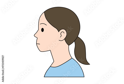 Comparison of female side profiles showing overbite and normal alignment, medical dental orthodontic illustration for healthcare and educational use