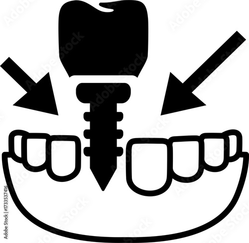 Tooth Transplantation