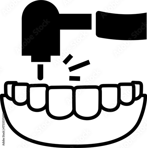Tooth Cavity Filling
