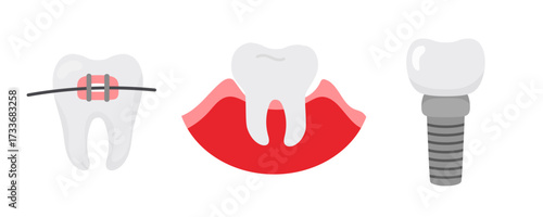Tooth and gum illustration in flat style. Tooth with braces and implant. Design element, icon set. Oral care, dentistry.
