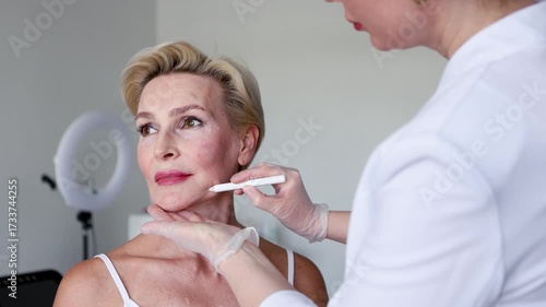 Closeup of mature woman with face contour lines during anti-aging consultation at beauty clinic. Dermatologist preparing for cosmetic facelift procedure. Skincare, rejuvenation and aesthetic treatment