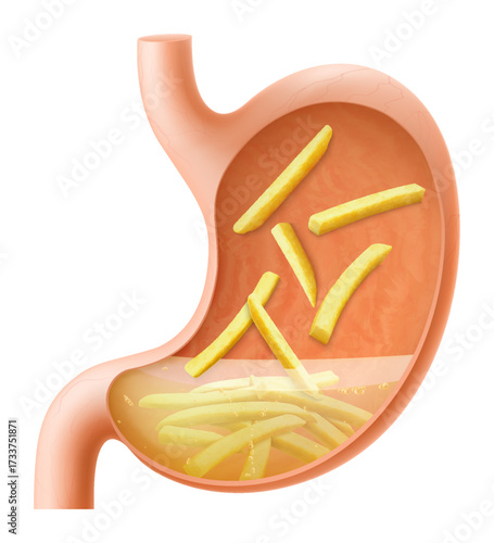 Human Stomach filled full by fast food. Gastric juice digesting French fries. Stomach with seasoned chips inside Illustration about digestive system. Realistic 3d Vector
