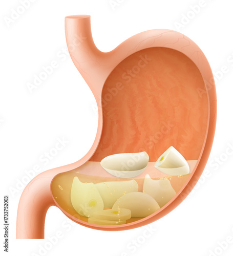 Human Stomach with garlic. The stomach digests garlic cloves. A stomach filled with healthy and wholesome food. Proper nutrition. Realistic 3d Vector illustration. Food digestion process illustration