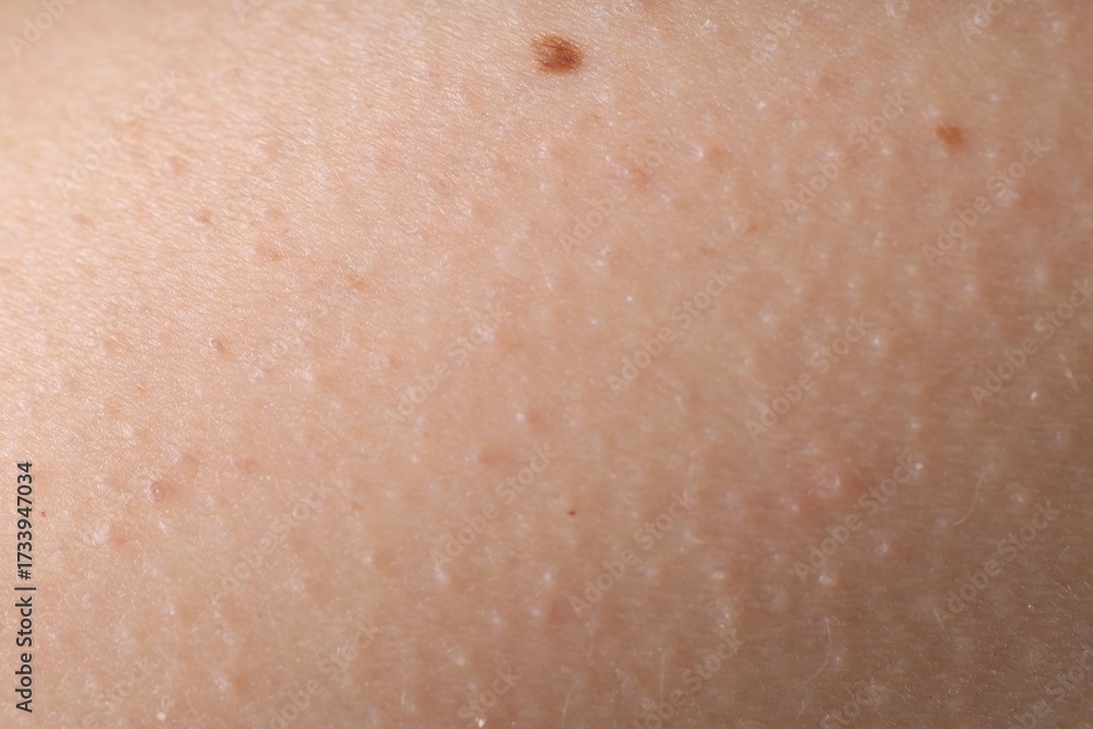 Fototapeta premium Texture of normal skin as background, closeup