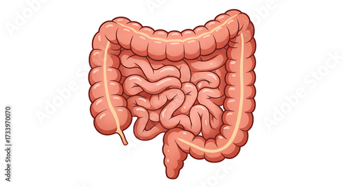 Illustration of a human colon, showing its complex structure and shape, on a white background.