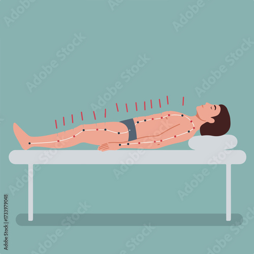 Person lies on massage table with acupuncture needles inserted along meridian lines