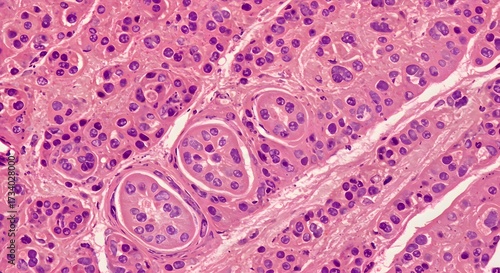 Foto A histopathology slide of prostate tissue showing cellular structures and tissue organization under a microscope