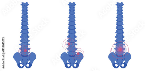 Spine Health Awareness Understanding Back Pain Spinal Anatomy and Common Problems for Optimal Health Posture and