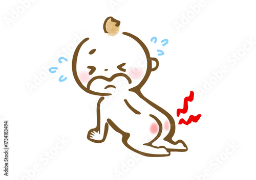 おむつかぶれが痛くて泣いている赤ちゃんの手描きイラスト