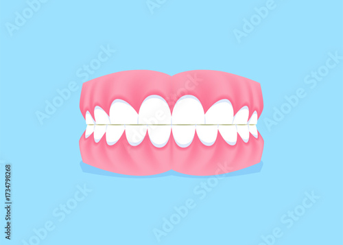 Full mouth teeth - Attrition illustration vector design. Dental care concept.