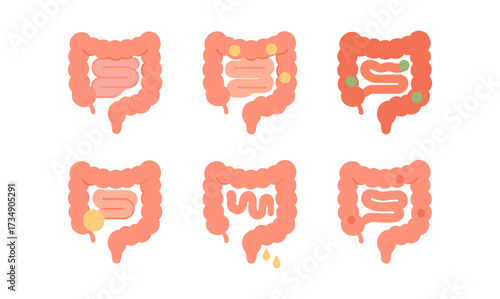 Human digestive system health: colon conditions and functions in flat design