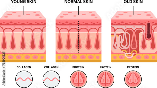 Comparison of young normal and old skin layers and components