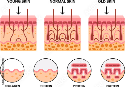 Diagram showing skin aging from young skin to old skin