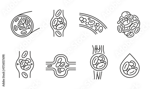 Blood clot pictograms showing vessel obstruction.