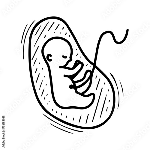Baby in the womb. Hand drawn doodle vector. Medical examination of pregnant woman. Ultrasound image. Child, childbirth, umbilical cord. Line art illustration.