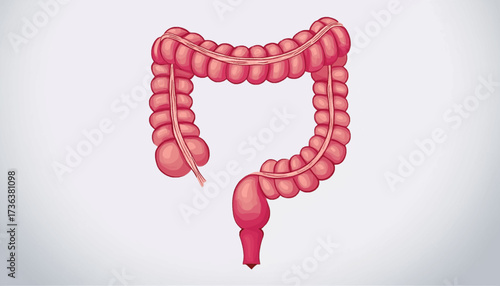 An anatomical illustration of the human large intestine, also known as the colon, a vital organ in the digestive system.