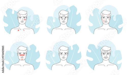 Male skin problem line icons set vector illustration. Outline man different types of medical skin troubles collection, dark circle under eyes and wrinkles, acne and melasma, blackheads and rosacea