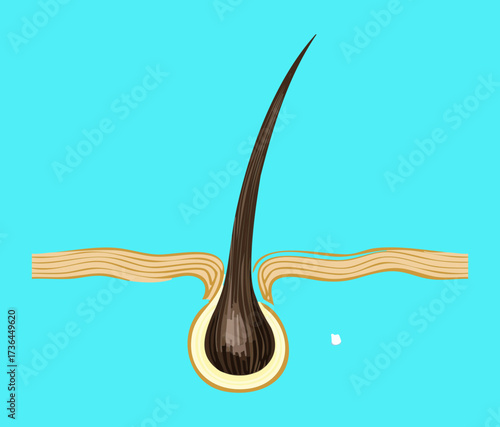 Cross-section illustration depicting the process of hair removal where the shaft is being pulled from the follicle