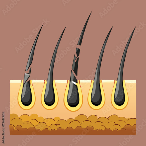 Cross-section graphic of damaged hair follicles and shafts indicating hair breakage or unhealthy growth due to stress