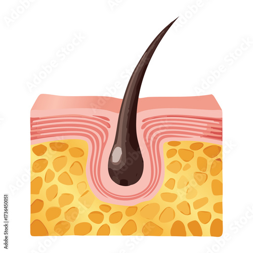 Anatomical Diagram of Hair Follicle Embedded in the Dermis, Showing the Bulb and Blood Supply Essential for Hair Growth	