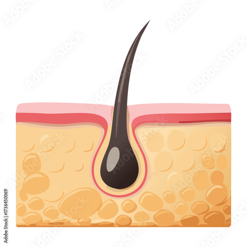 Educational medical cross-section showing a hair follicle structure embedded in the skin with a visible hair root