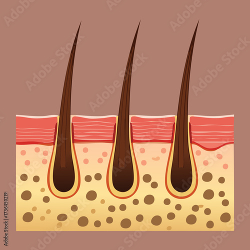 Cross Section of Skin with Hair Follicles Showing Melanocytes, Explaining Hair Color Pigmentation and Graying Process	