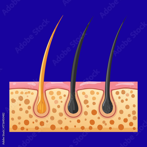 Structure of Hair Follicle Beneath the Scalp with Deep Root and Associated Glands, Essential for Understanding Hair Loss Treatments	