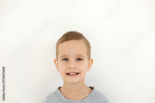 A little boy on a light background, smiling, bad teeth, oral diseases. Children's teeth covered with black plaque, dentistry, teeth cleaning, happy child, children's teeth treatment