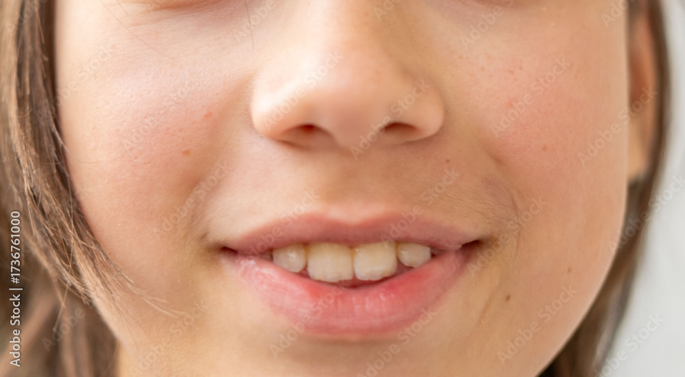 Obraz premium optimistic cheerful teenage boy with wide and genuine smile, open-mouthed smiling, dental health, candid closeup portrait, moment pure happiness and youthful joy, positive emotion childhood