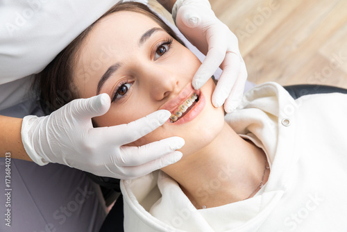 Close up of orthodontist checking brackets on female teeth. Concept of stomatology, dentistry, orthodontic treatment of braces
