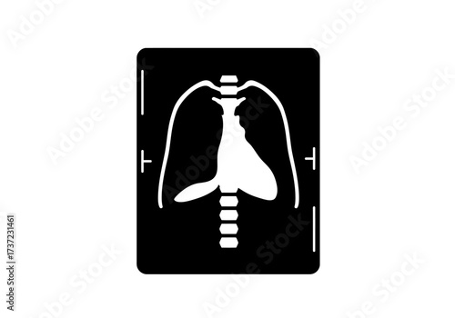 Black and White Chest XRay Silhouette with Spine and Ribs.