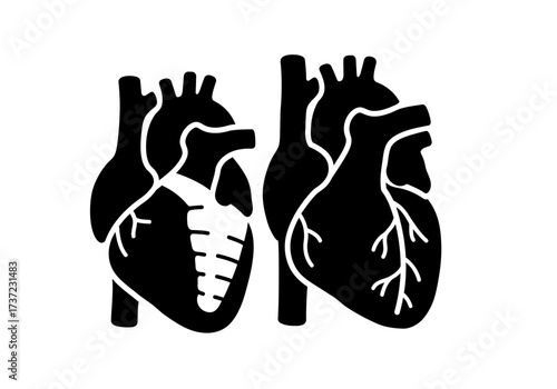 Stylized black human heart icons one with internal anatomy the other with external coronary vessels.