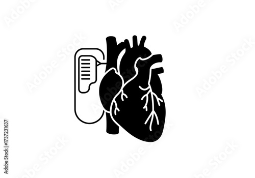 Heart Pacemaker Silhouette Medical Device for Cardiac Rhythm Support.