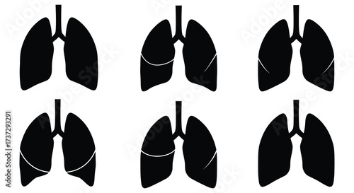 Simple black and white illustration depicting a pair of human lungs