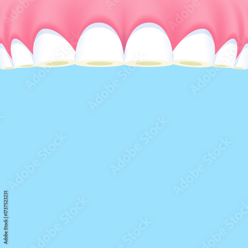 Upper teeth (Attrition) - Text box banner (square) illustration vector design. Dental care concept.