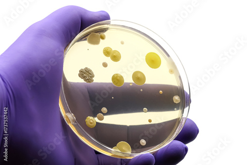 Purple glove with Petri dish of microorganisms culture. Bacteria.