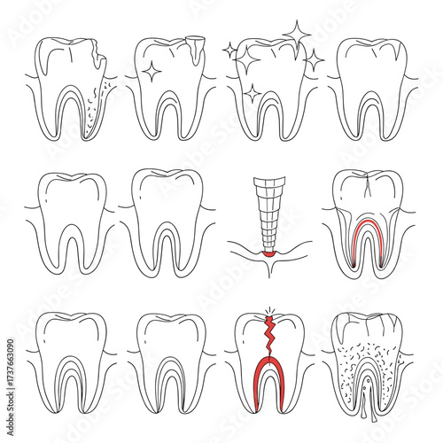 Visualizing different stages of dental health and common dental issues a comprehensive graphic overview.