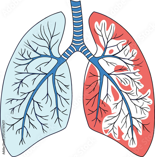 Lungs illustration highlighting respiratory health issues, perfect for medical education and health campaigns, anatomical lung design, science, and wellness